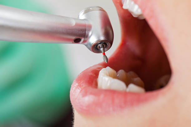 Best Pediatric Emergency Dentist in Athens, WV